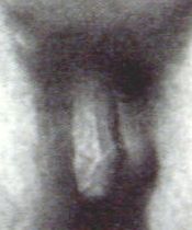 L�pez nude's penis